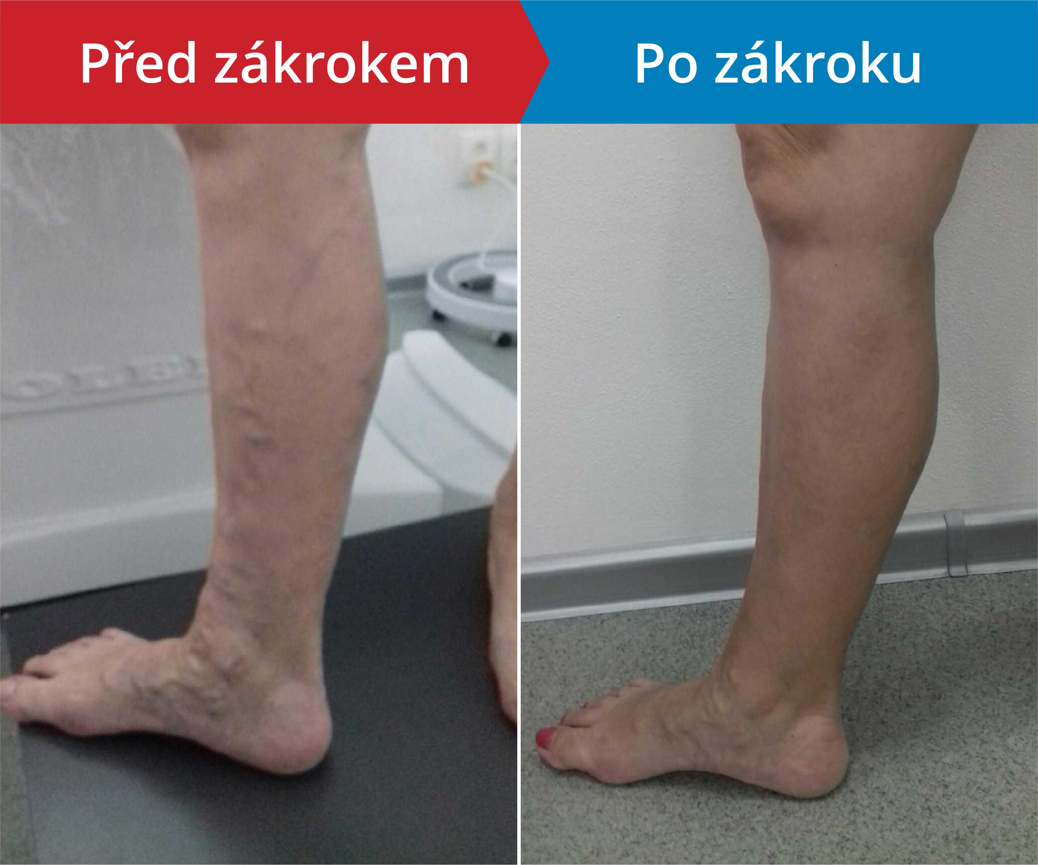 Načítám foto